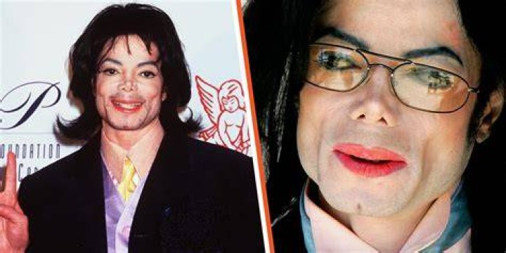 Did Michael Jackson Have a Disease? Uncovering the Truth Behind His Health