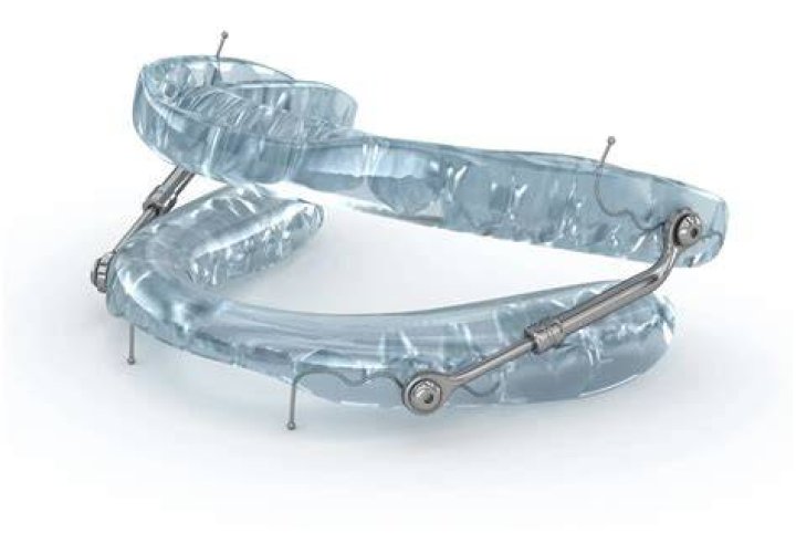 Roganleep Apnea Mouthpiece: Your Ultimate Solution for Sleep Apnea